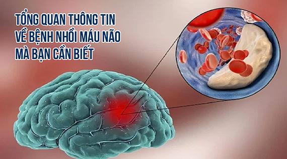 Giải pháp hay của villa ở Hội An - khuyến khích khách lưu trú cùng chung tay vào “Cuộc chiến chống rác thải nhựa”