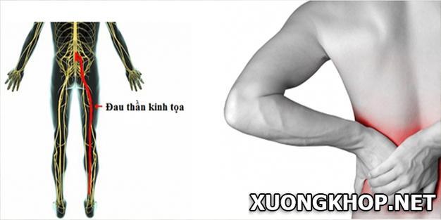 Phòng Suite là gì