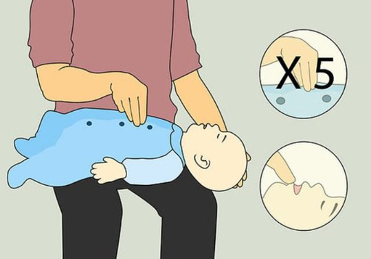 trẻ bị hóc dị vật đường thở, xử lý thế nào