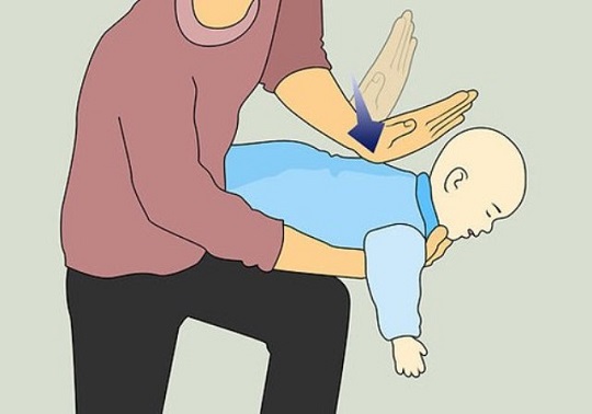 trẻ bị hóc dị vật đường thở, xử lý thế nào